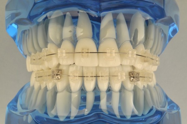 ortodoncia sevilla, clínica dental sevilla, dentista sevilla