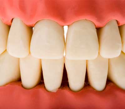encías-con-espacio-entre-los-dientes, solución de encías en sevilla