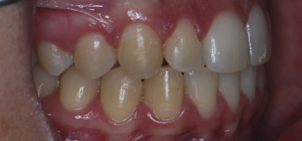 ortodoncia sevilla