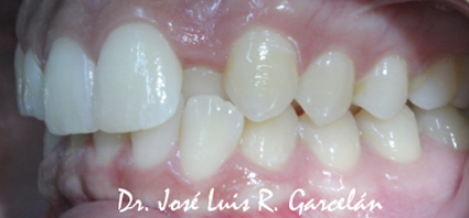 ortodoncia sevilla