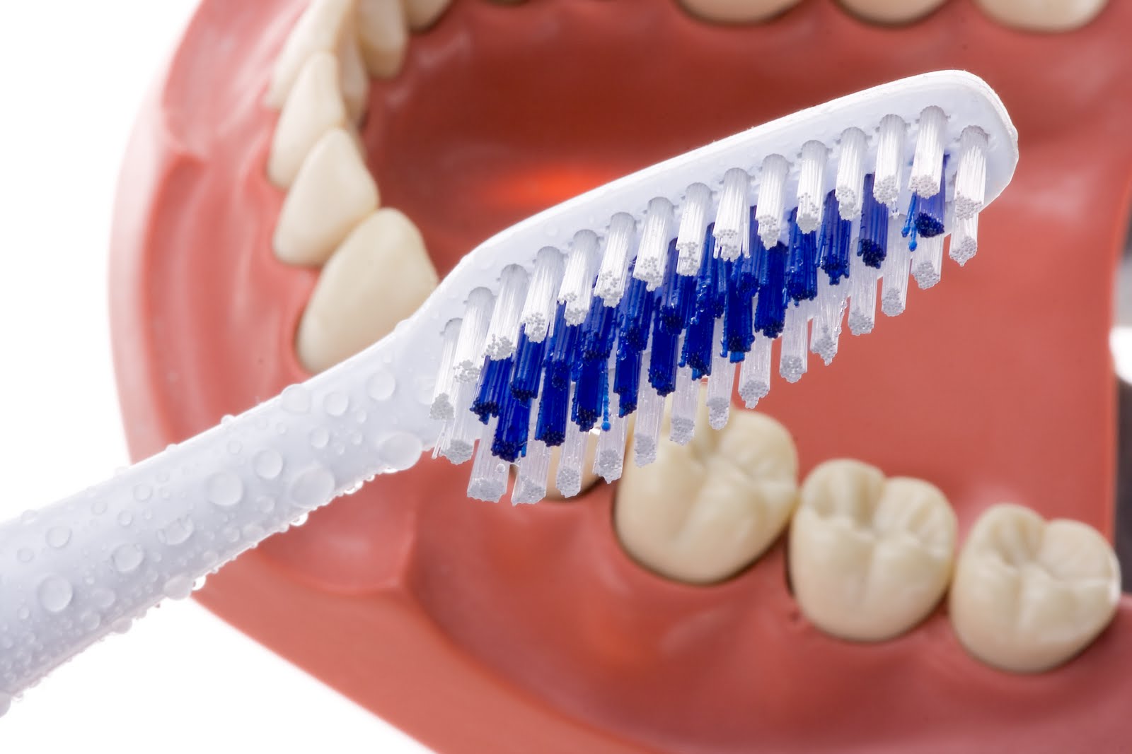 Модель полости рта. Щетка для съемных зубных протезов. Зубные щетки для несъемных протезов. Зубная щетка для коронок. Зубная щётка для протезов.