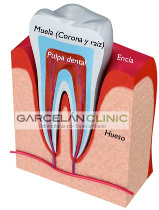 ¿Cómo es una muela por la mitad?, endodoncia realizada correctamente, endodoncia sevilla, dentista sevilla, clinica dental sevilla